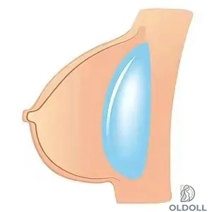Gelly  + 79.00€ 