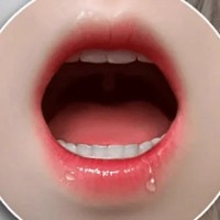 ROS Kopf (Oralfunktion) 